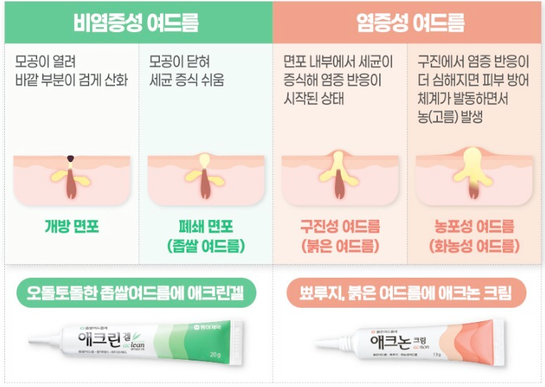 Aclean Gel - COMEDONAL ACNE TREATMENT GEL 20g 애크린 겔